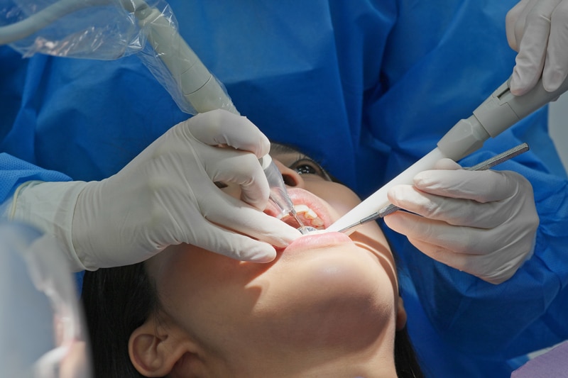 A dentist in gloves and a blue gown works on a patient’s open mouth with dental instruments in a close-up of the procedure.
