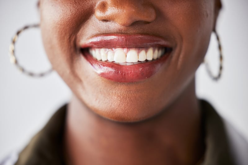 Close-up of a smiling person with white teeth, hoop earrings, and a dark shirt. The lower half of the face is shown on a neutral background.