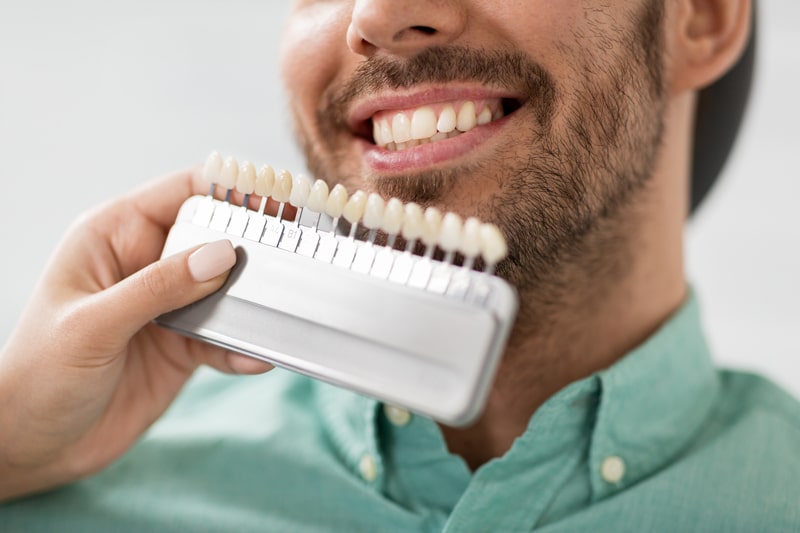 A man with a beard smiles as someone holds tooth color samples to his teeth for a dental shade match. He wears a green shirt.
