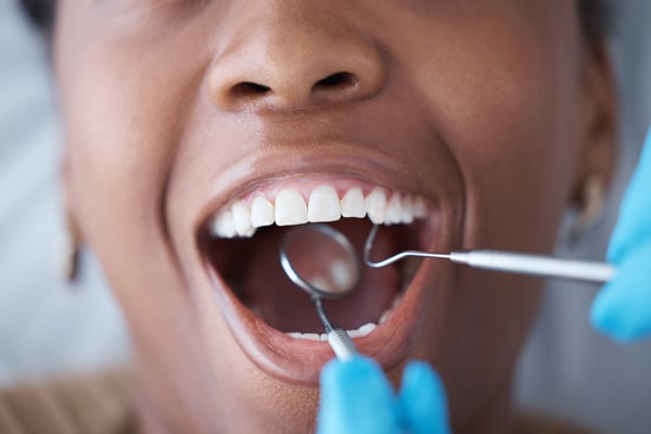 A person sits at the dentist with their mouth open while a dental professional in blue gloves checks their teeth using tools.